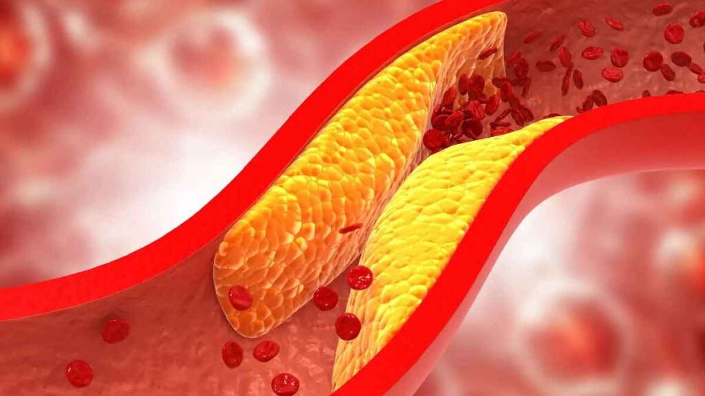 How to lower cholesterol naturally